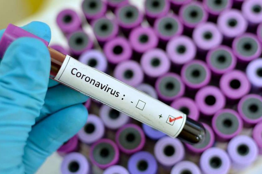 Steckt der Coronavirus die deutsche Wirtschaft an?